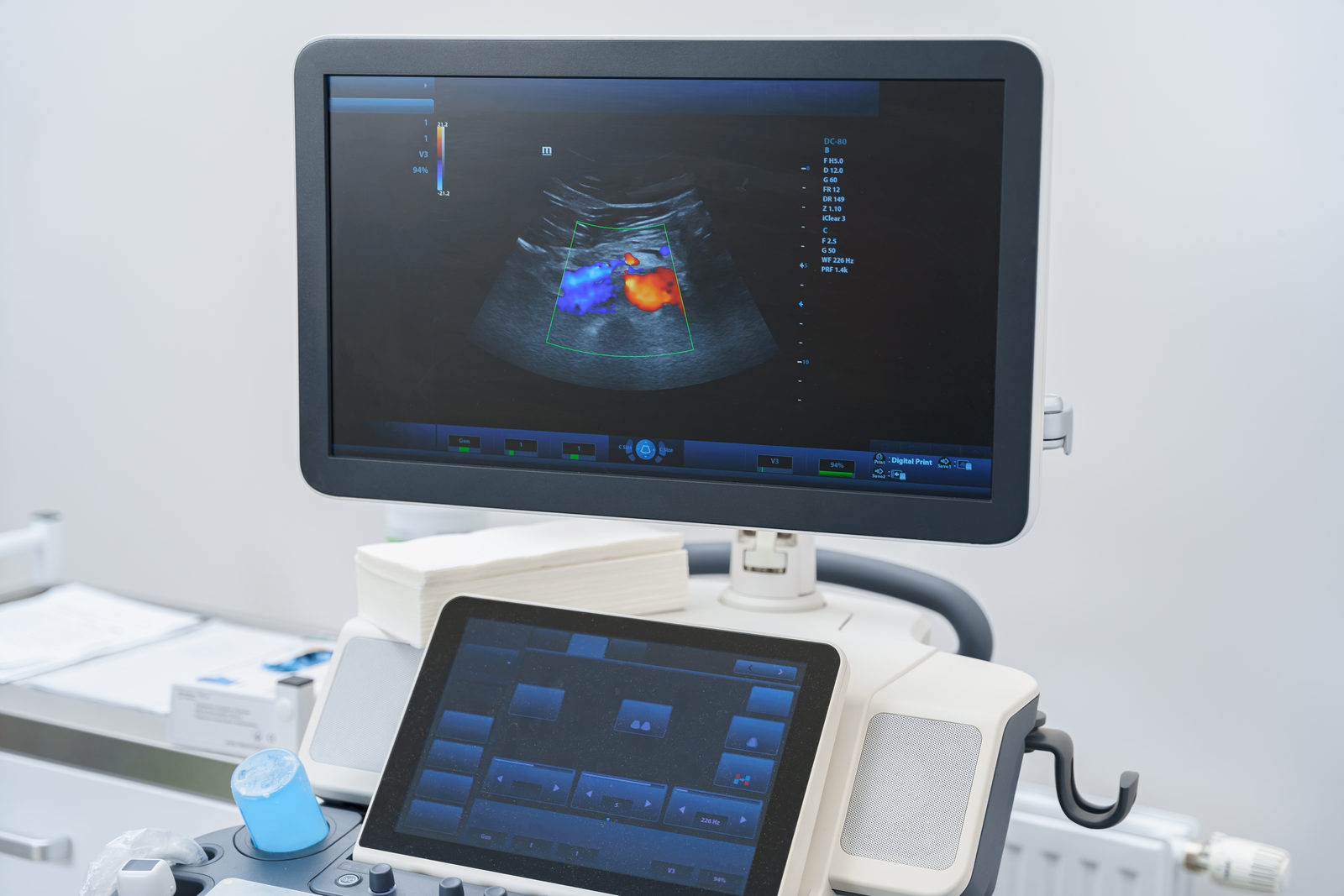 Ultraschallgerät mit farbigem Doppler-Bild auf dem Monitor
