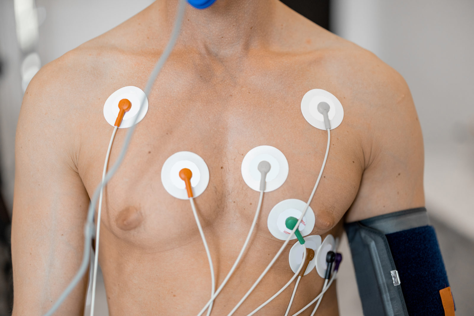 Oberkörper mit EKG-Elektroden und Blutdruckmanschette während eines Belastungstests